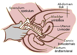 Internal Pelvic Exam