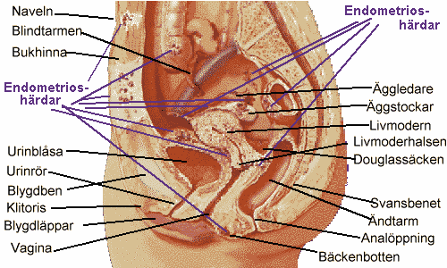 en tecknad genomskärningsbild som visar nedre buken, underlivet hos en kvinna